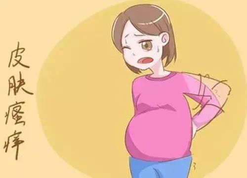                     涉外月嫂:孕期皮肤瘙痒的原因及治疗方法