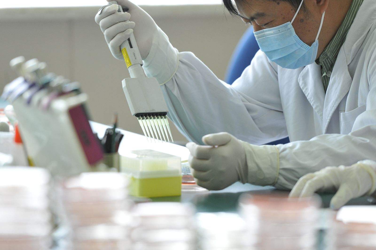 医院检查尿酸多少钱一次 b6f9690cb4b54627a45194bb47d70d59.jpeg