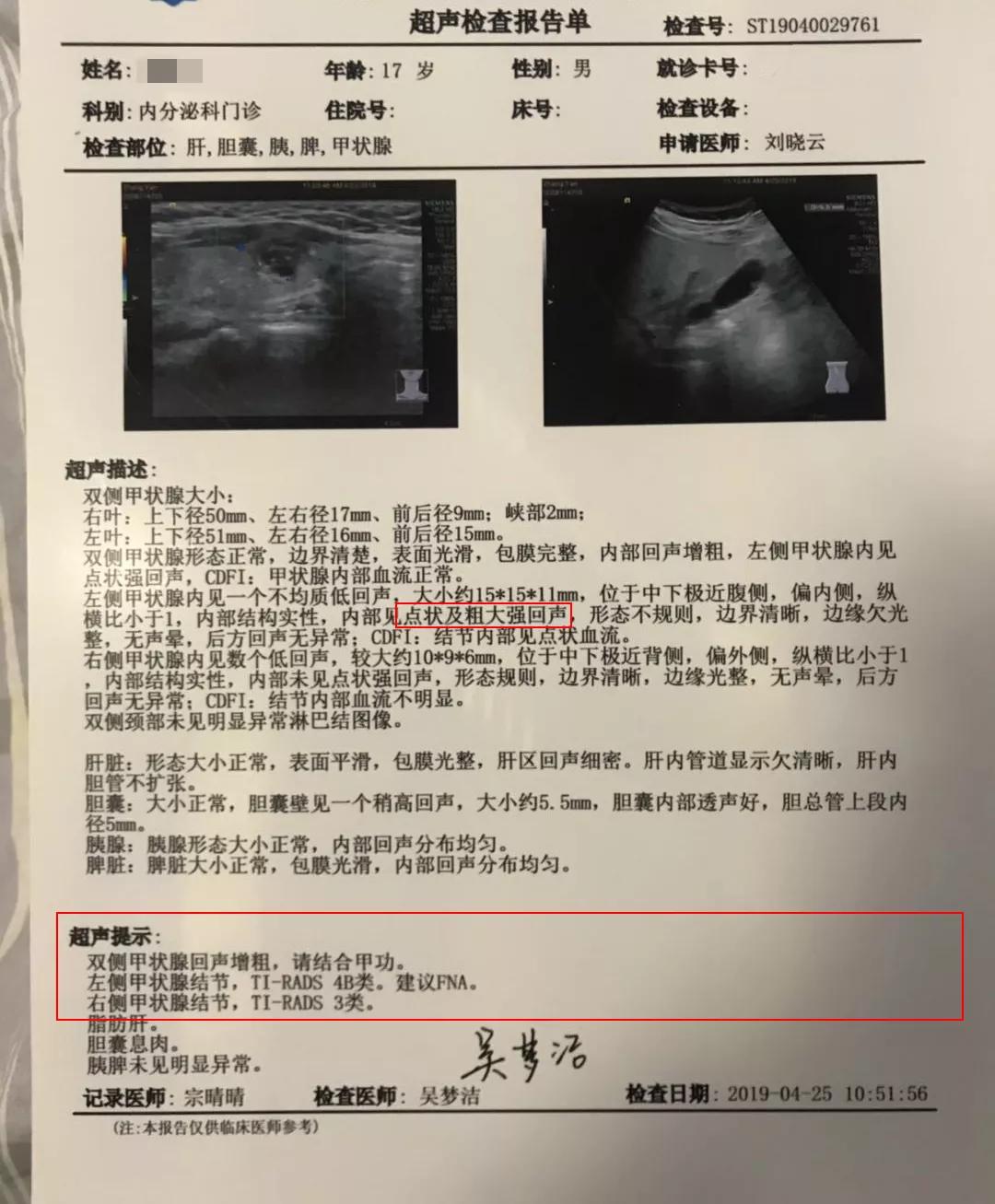 结节不重视!一年内17岁男孩基因检测v600e突变确诊为甲状腺癌