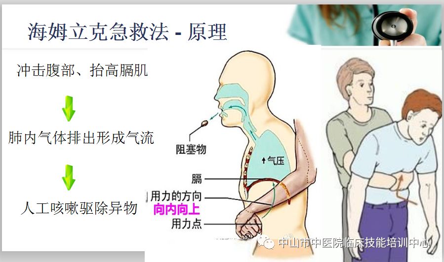 心肺复苏及海姆立克急救法你学会了吗