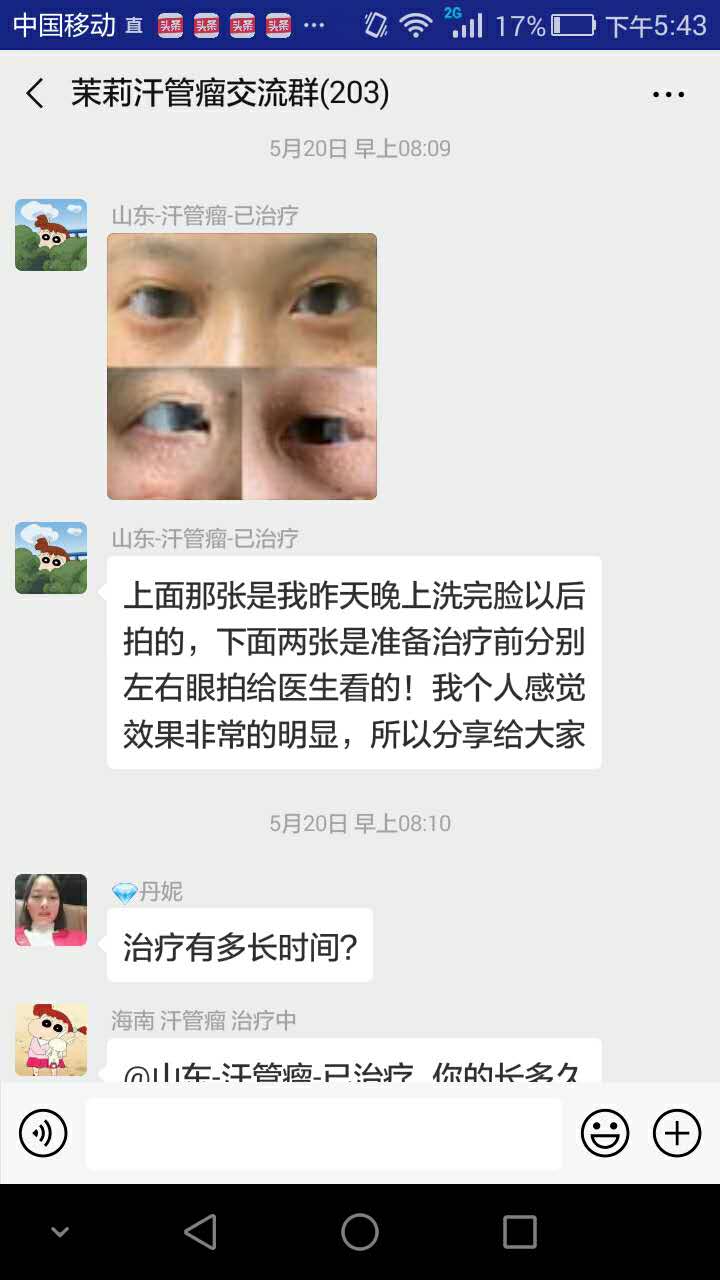 这样做治疗汗管瘤再也不用走弯路