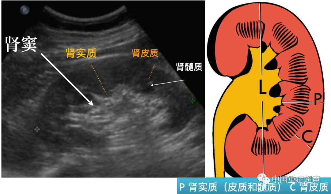 7)肾盂:是肾脏的一部分,呈圆锥形的囊状结构,下