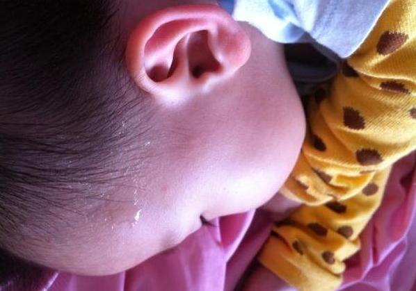                     孩子爱出汗是因为缺钙？医生：八杆子打不着，主要是这3个原因