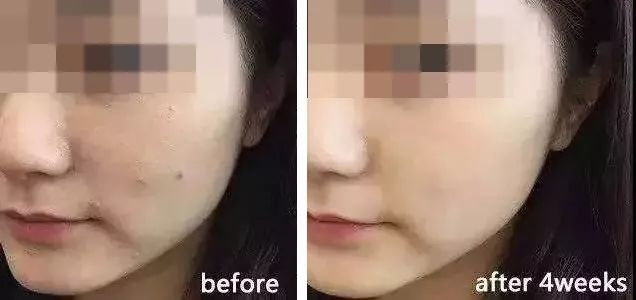 fab437d503ca45c39b2834ca98245d5e.jpeg