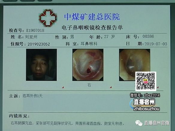 怎么样可以让自己耳膜穿孔 0e8ff695cb594fb1a78967e67c58976d.jpeg