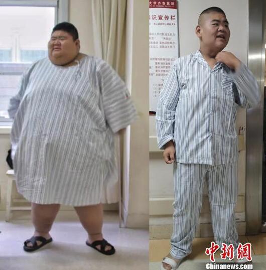 图为王浩楠减肥前后对比图.左为668斤,右为268斤.(拼图) 郝学娟 摄