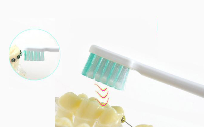 牙科医生任欢科普：牙齿矫正期间应当如何预防蛀牙？
