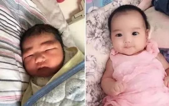                     为什么刚出生的娃长得像“小老头”？