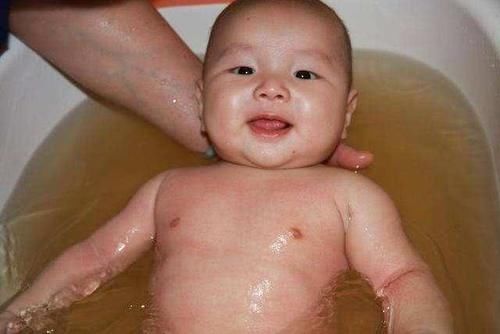                     夏季天气炎热，宝宝湿疹反复发作怎么办？3个方法让宝宝远离湿疹