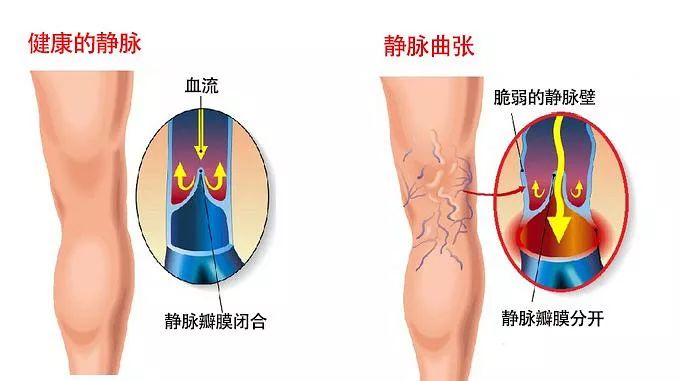 老人口恶臭(3)