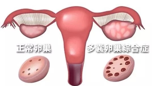不孕不育的现状与未来趋势