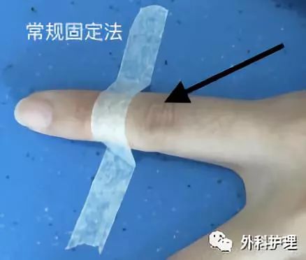高举平台法,管路固定就看这一篇!绝对实用!