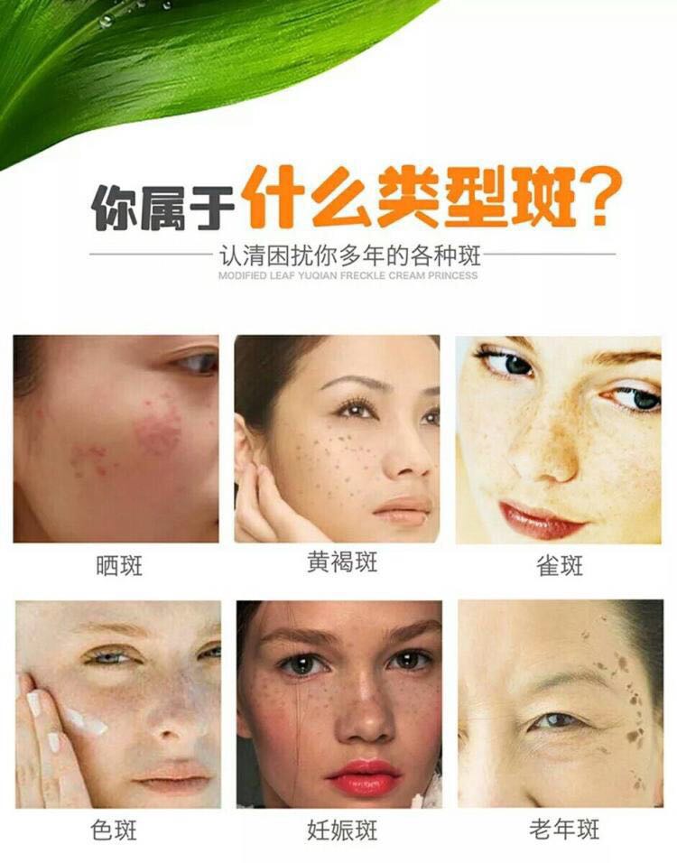 皮肤发黄暗沉无光