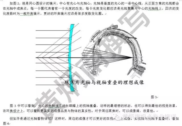 环焦镜片的原理_黄炳南 环焦镜片的定配原则与注意事项