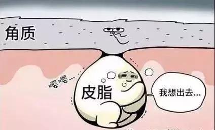 粉刺脓包怎么处理 21c9580837c2420db5cee53082953be0.jpeg