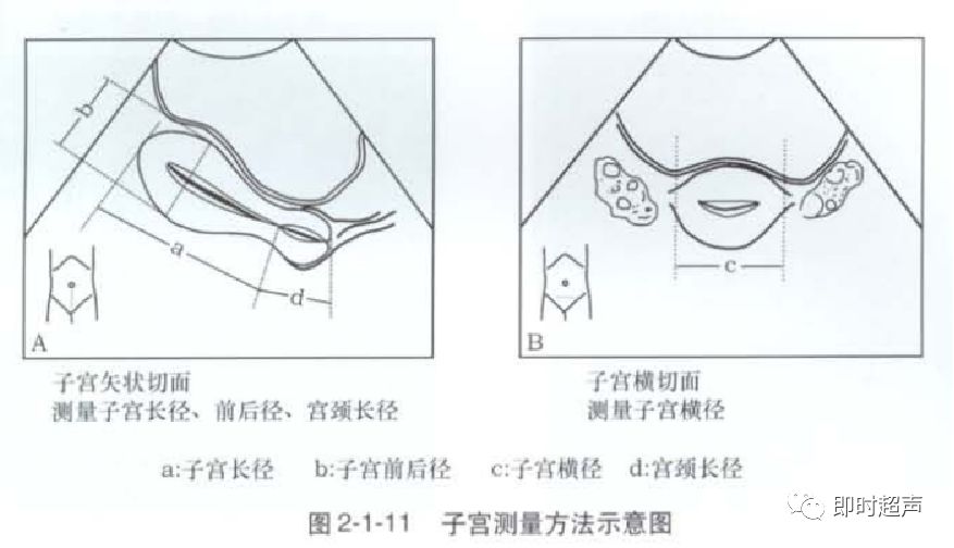 子宫形态异常及子宫内膜周期性变化