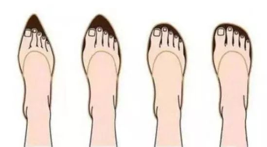 怎么解决脚趾难看 5cde2e0d26fc4b02b46b937fe92c05bb.jpeg
