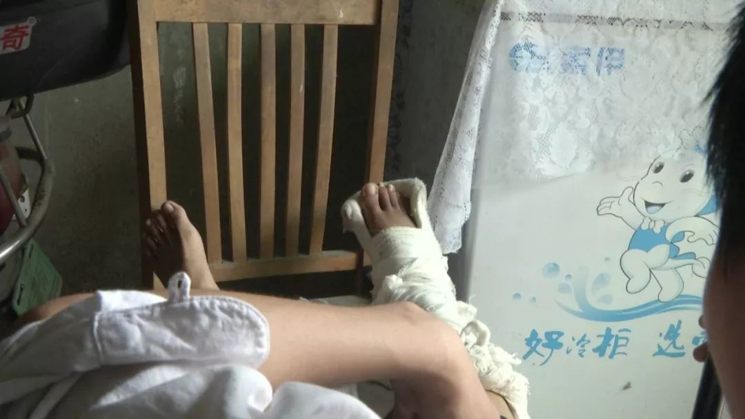 在卧室里,孙瑜见到了丁海文,他坐在轮椅上,右脚打着厚厚的石膏,桌上摆