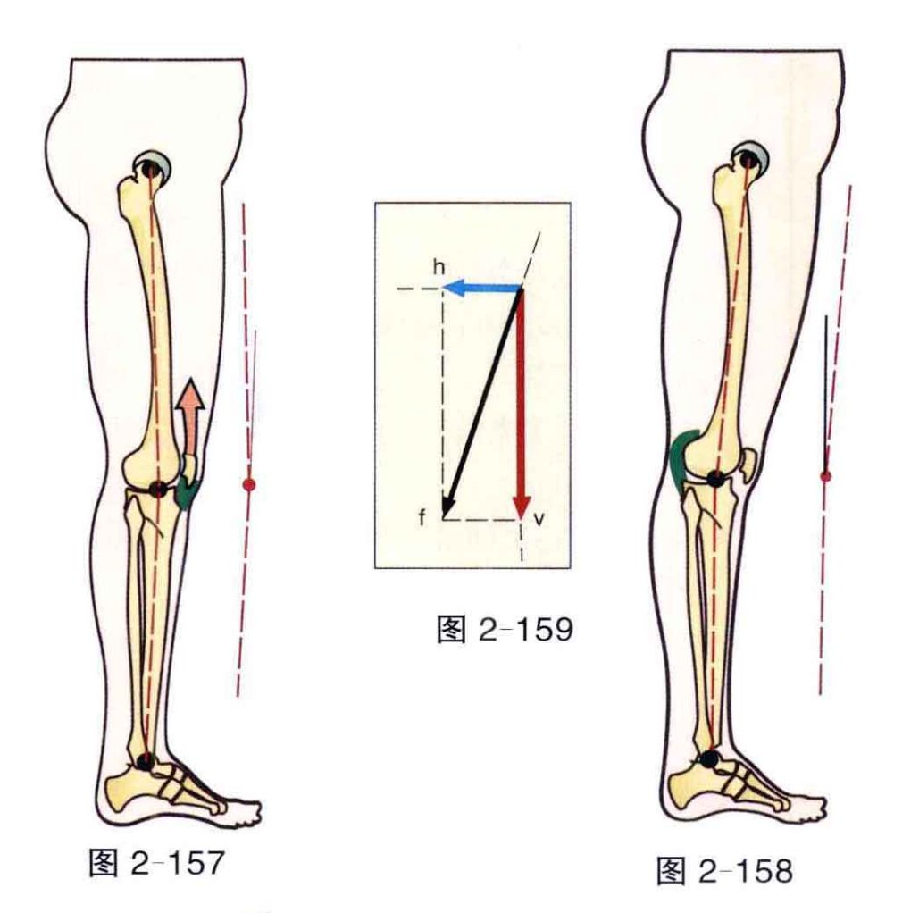 视觉影响2:肌肉功能和生物力学的变化而且,两点之间直线最短,当大小腿