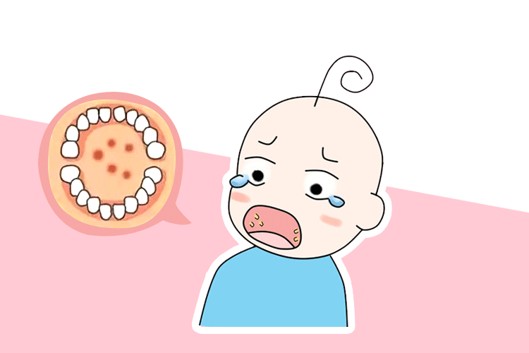 夏季孩子容易得这4种病,不少孩子已中招!专家来支招