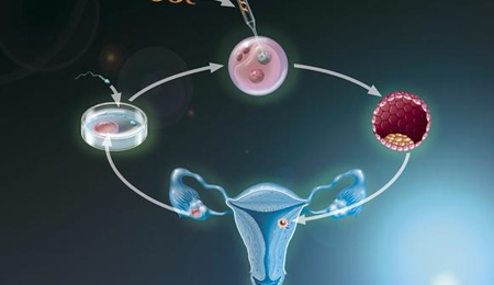 做试管婴儿时降调、促排卵遇到的问题和解答