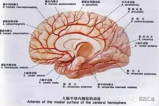 脑桥出血