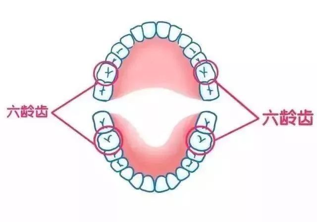 六龄齿终生不替换,没了就是没了,父母不要等孩子牙齿坏掉了再后悔莫及