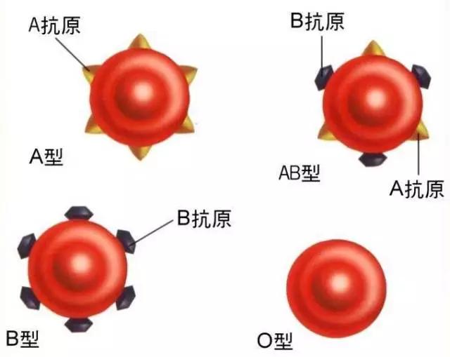                     O型血母亲的忧伤：因为找了B型血的老公，生了溶血的宝宝