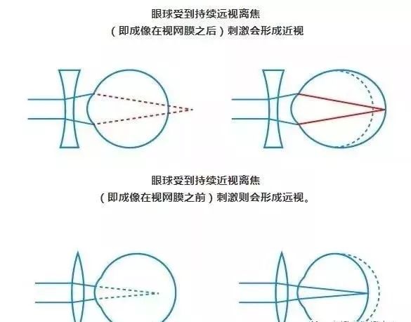 配镜矫正视力什么原理_散光是什么配镜原理