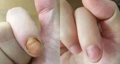4551d4ec0006456d828a27c0e8b885cb.jpeg