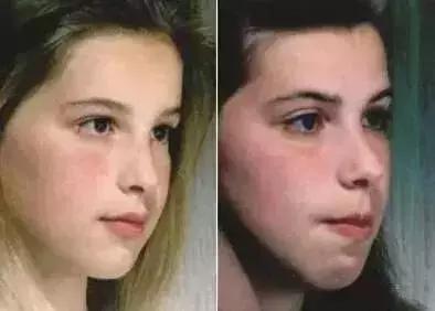                     为什么女儿像爸爸，男孩随妈妈？其实决定宝宝颜值的是这几点