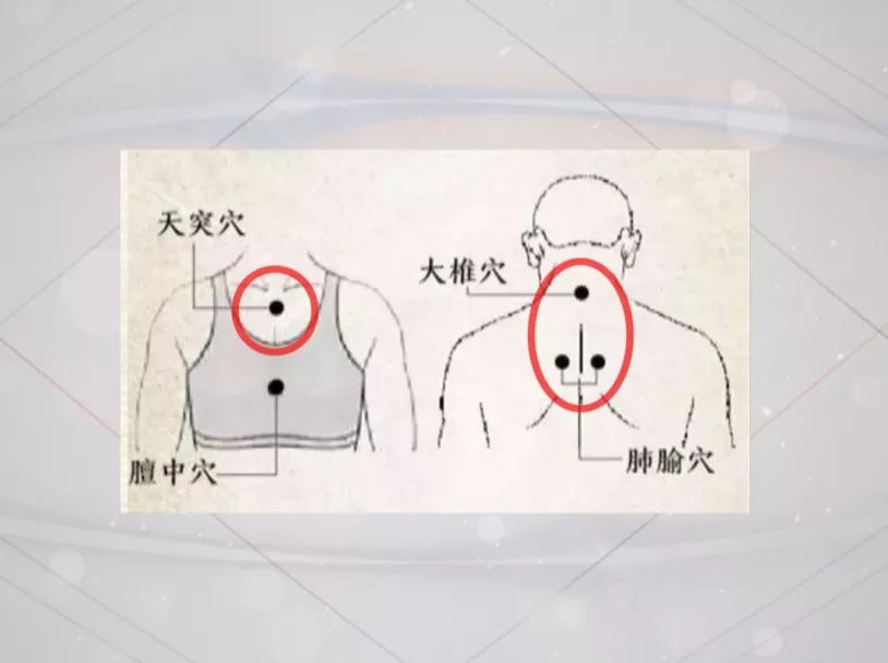 可选取五个穴位来贴三伏贴,根据咳嗽病症和喘憋病症不同,贴敷的穴位也