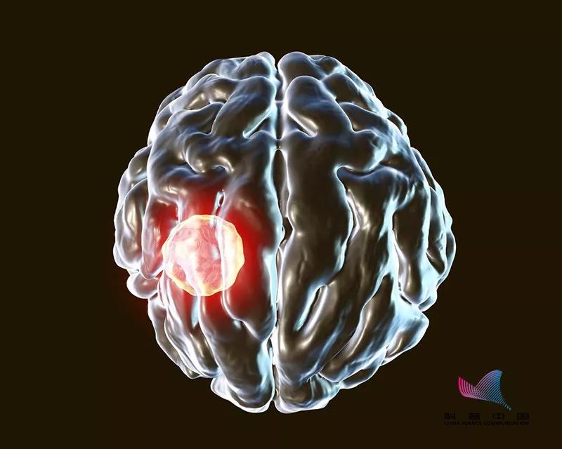 怀孕到底能不能养猫狗?会导致流产或畸形吗?