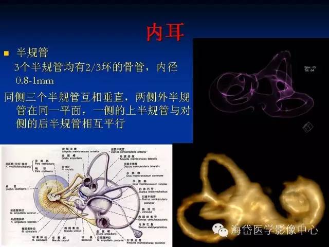 耳部ct及mri解剖