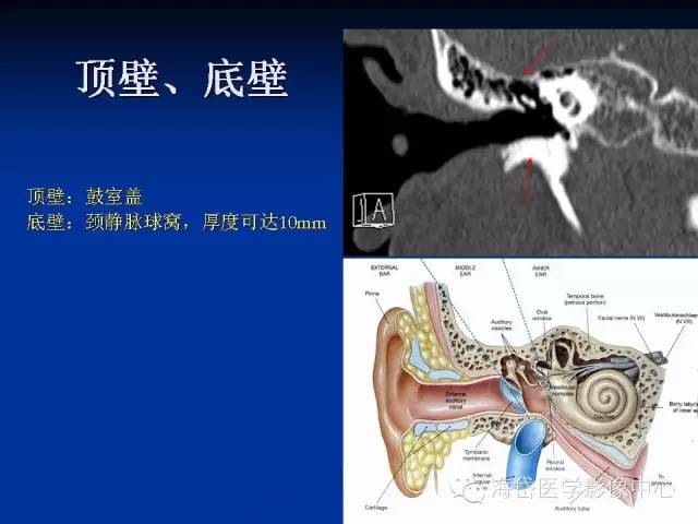 耳部ct及mri解剖