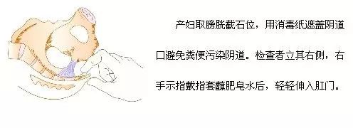 肛门检查 产妇取膀胱截石位,用消毒纸遮盖阴道口避免粪便污染阴道.