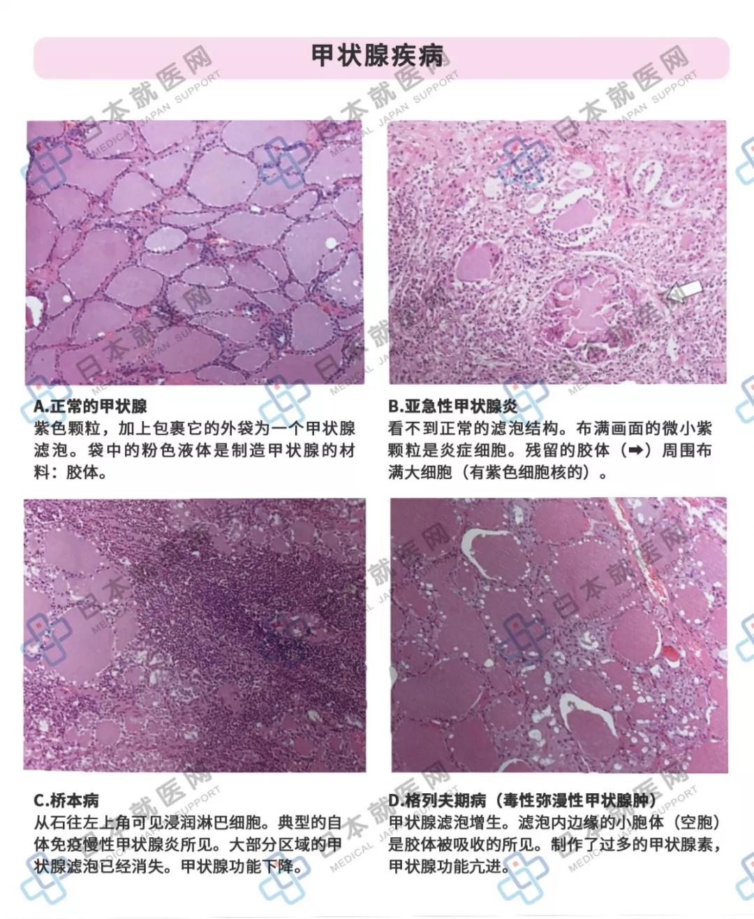 什么是特异性炎症