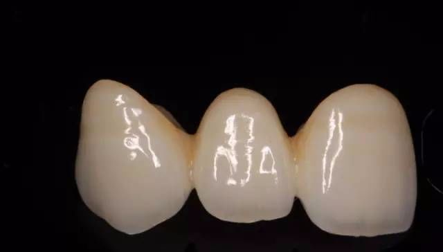 牙齿的十种美学形态与咬合功能