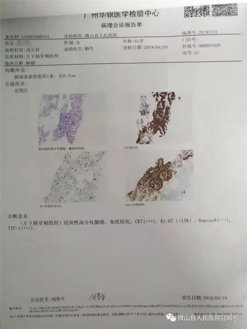 胸部ct检查显示以下是近期我科治疗的一例晚期肺癌患者:我院呼吸科自