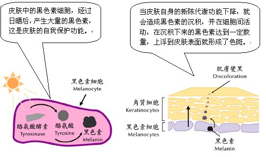 色素沉着是什么原因造成的呢 d7859a1a38d347ea9c100f4753da9969.jpeg