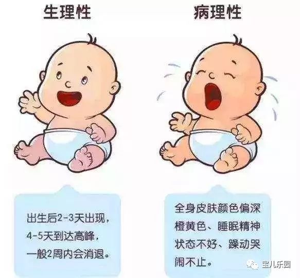 婴儿生理性黄疸怎么办