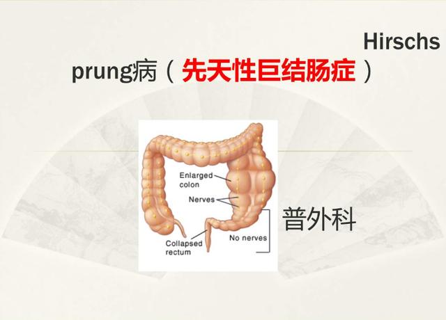 孩子出生两天以上没排便?当心先天性巨结肠,会有这些表现