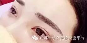 4aa44bfc4c5742bcae72b07e787142e4.jpeg