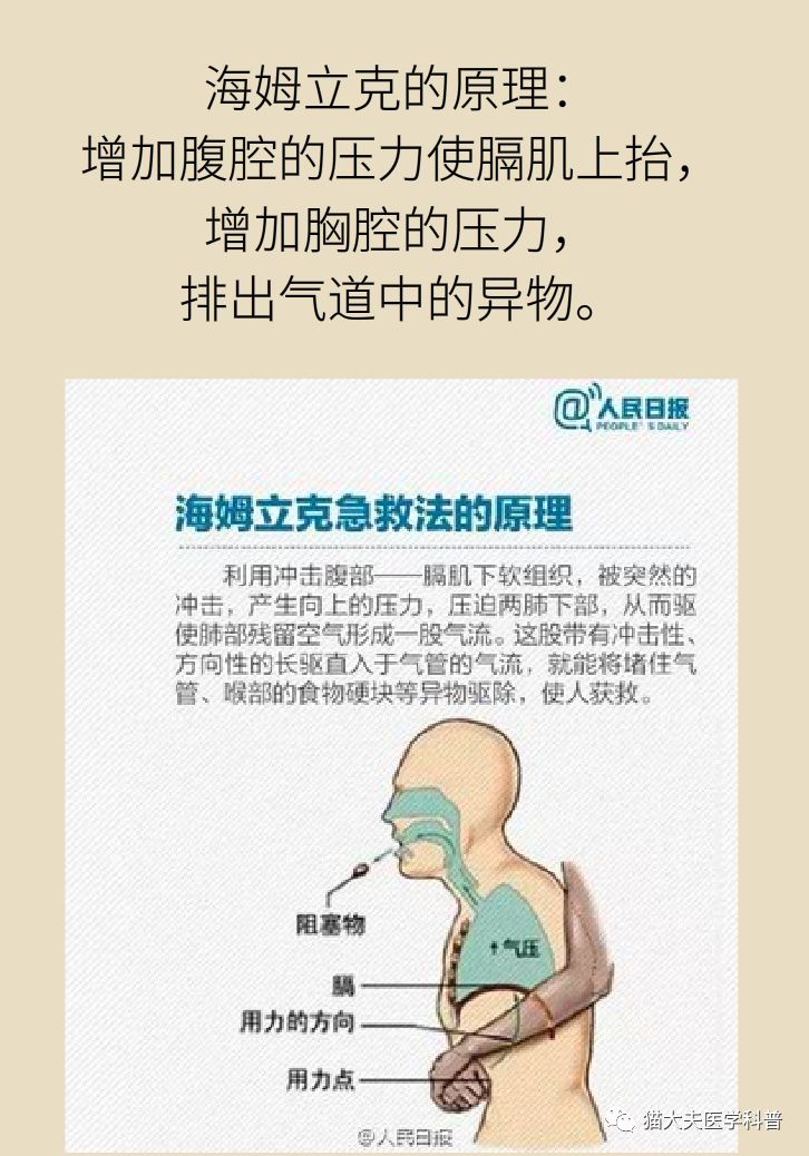                     多个孩子被噎身亡！家长再忙也要看：“剪刀、石头、布”关键时刻能救命！