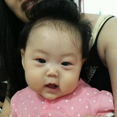                     “十孩九积”，孩子体内有没有积食，脸上4点很关键，家长需知道