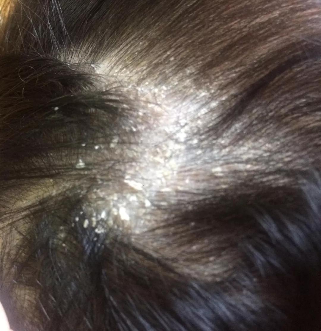                     炎夏宝宝该不该勤洗澡？澡后更适合做这个运动，不说你肯定不知道~