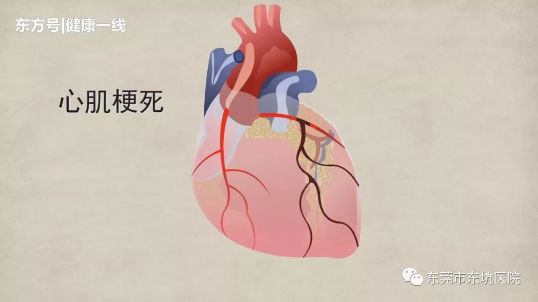 急速救治丨高龄老人突发心梗医养结合养老有保障