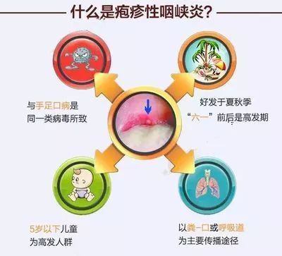                     5岁宝宝得病，哥哥和姐姐也接连中招！这种暑期高发病家长要注意