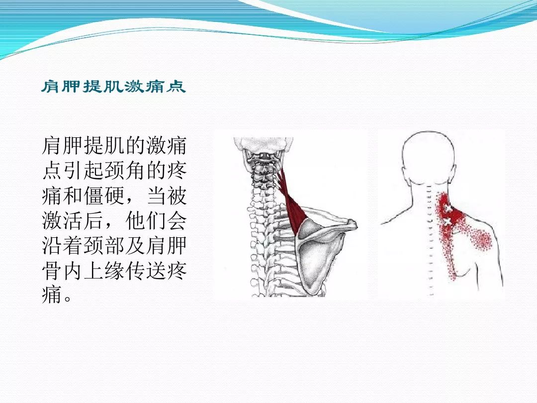 肩背肌筋膜炎的诊断及手法治疗概况