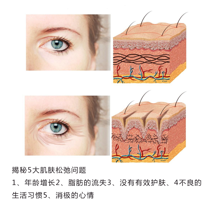 怎么去眼角细纹和法令纹 85522f64e8f544009647b4a136ac2b68.jpeg